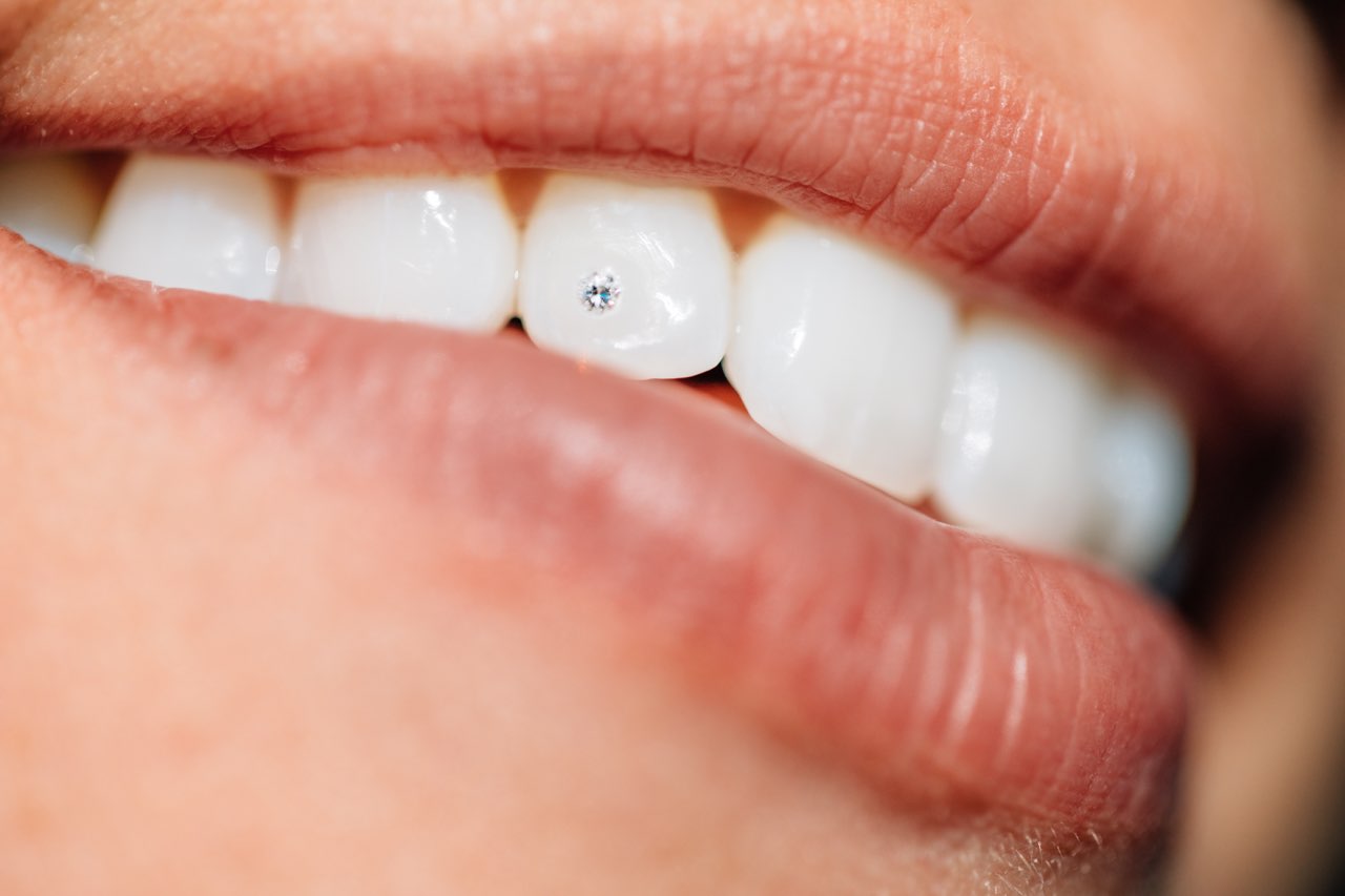Diamond stud tooth piercing Clearance